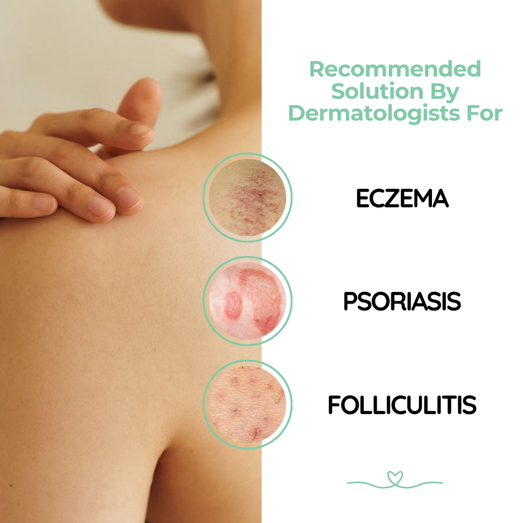 Atoskin Cream, Eczema Cream