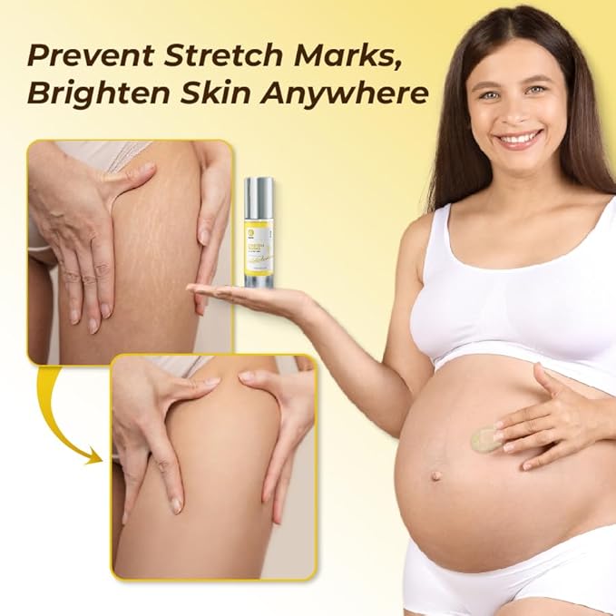 Belani Stretch Marks For Regnancy