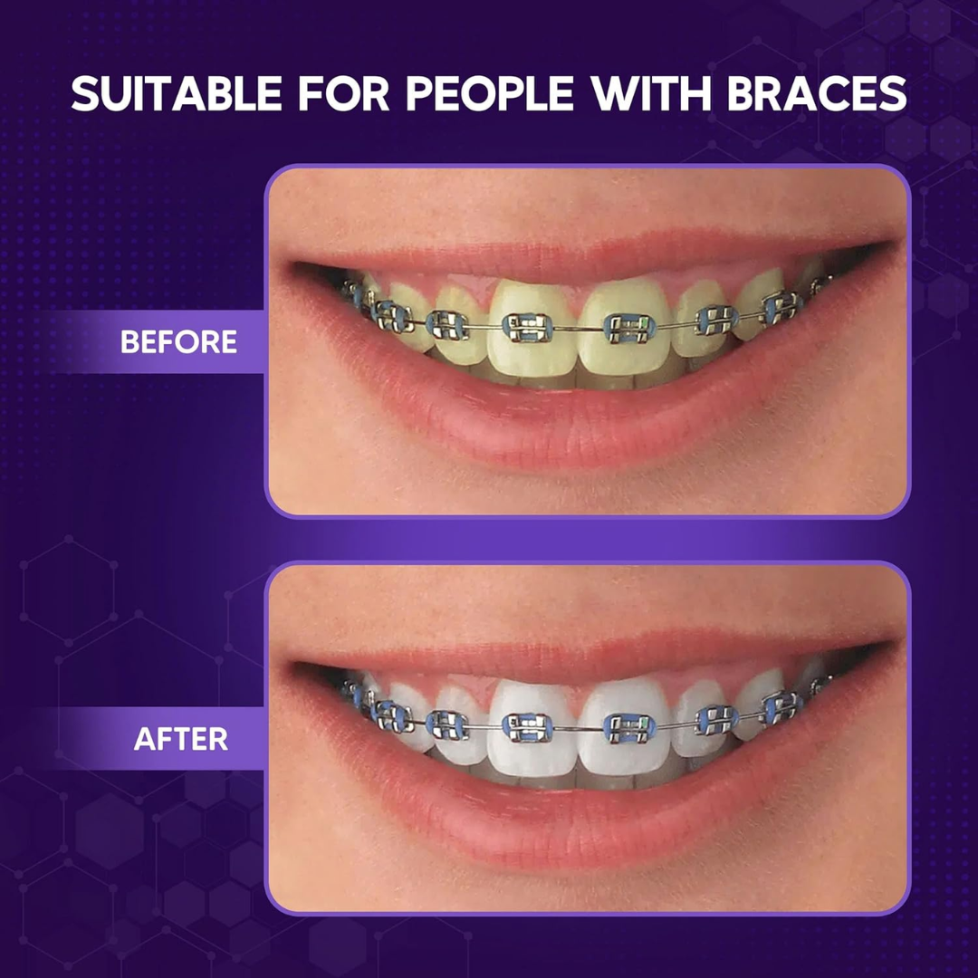 Abera Purple Teeth Whitening Foam