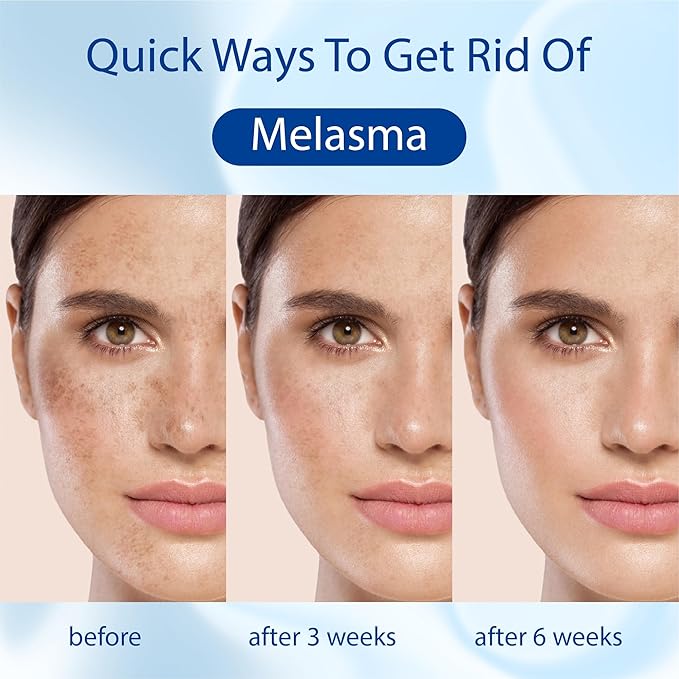 ABERA Retinol Serum to Reduce Wrinkles 20ml