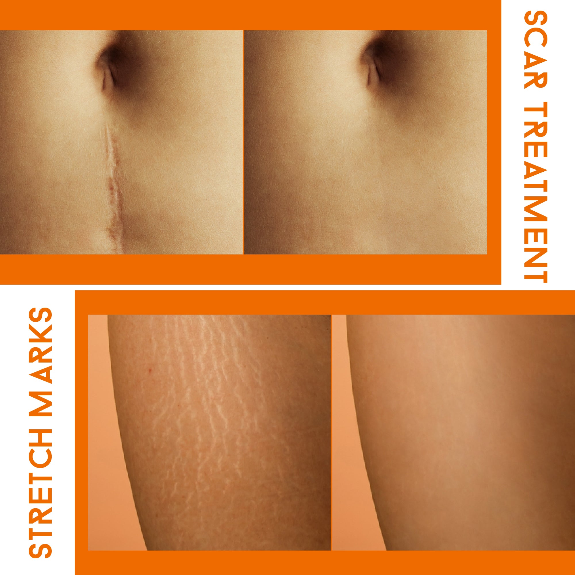 ABERA Red Turmeric Scar Removal Cream