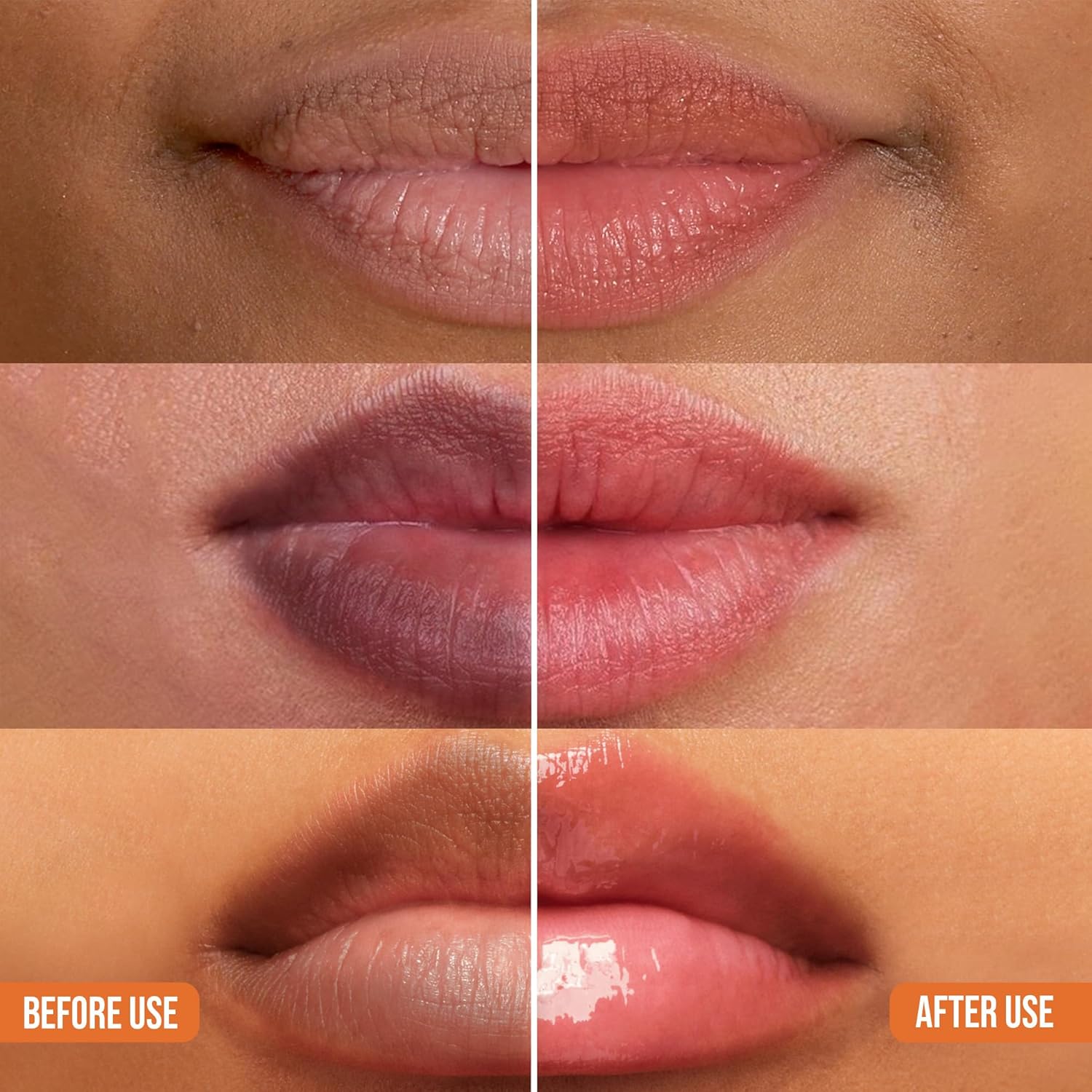 ABERA Dark Lips Corrector CreamMoisturizing Lip Balm