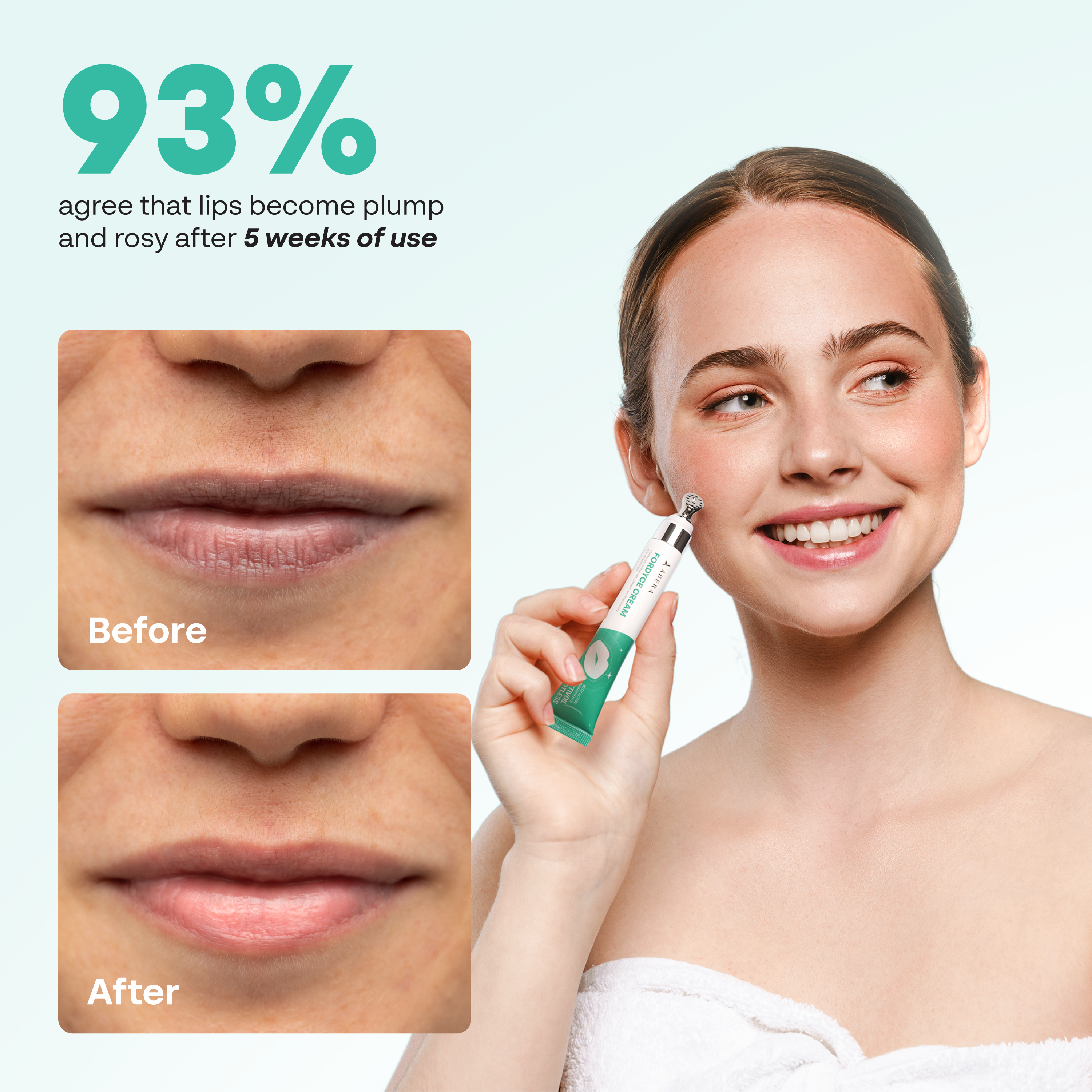 Abera Fordyce Lip Cream