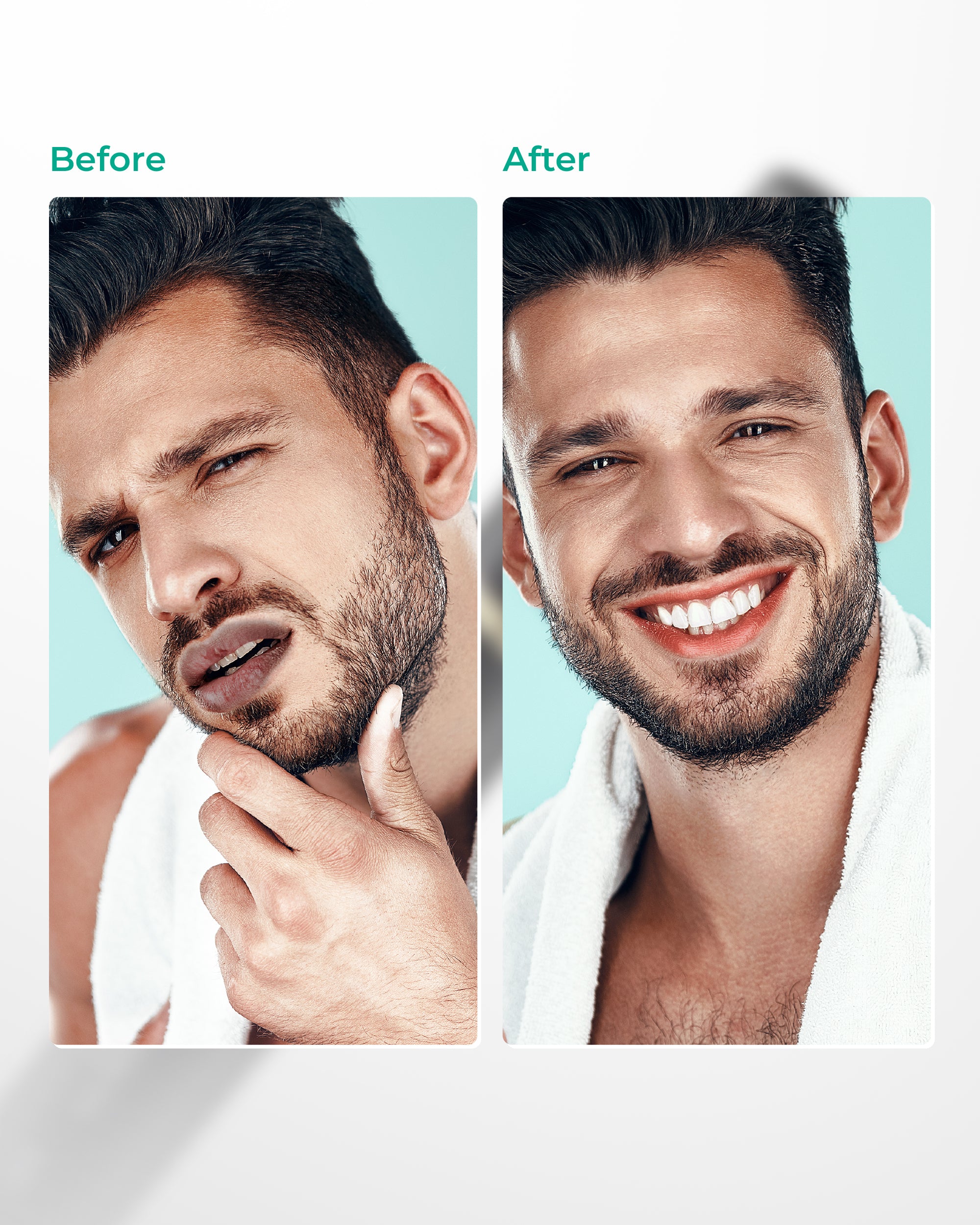 Abera Fordyce Spot & Dark Lip Care Set – Smooth Lip Appearance & Moisture Support with Botanical Extracts & Vitamins