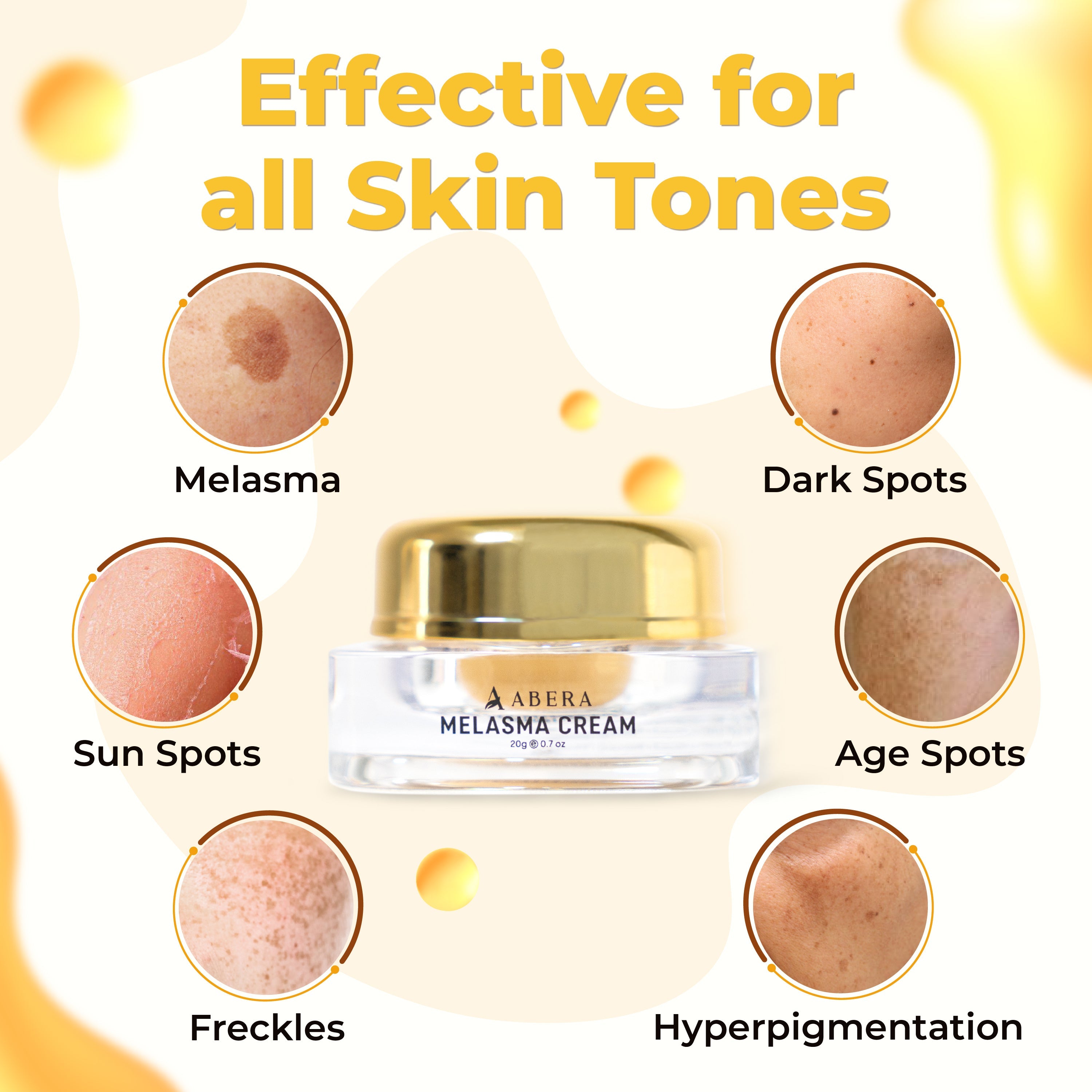 ABERA Melasma Cream 20ml (Premium Version)