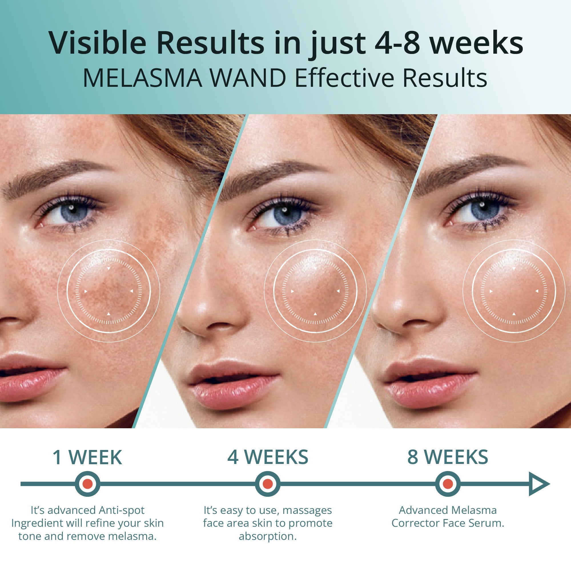 ABERA Melasma Serum Treatment 20ml