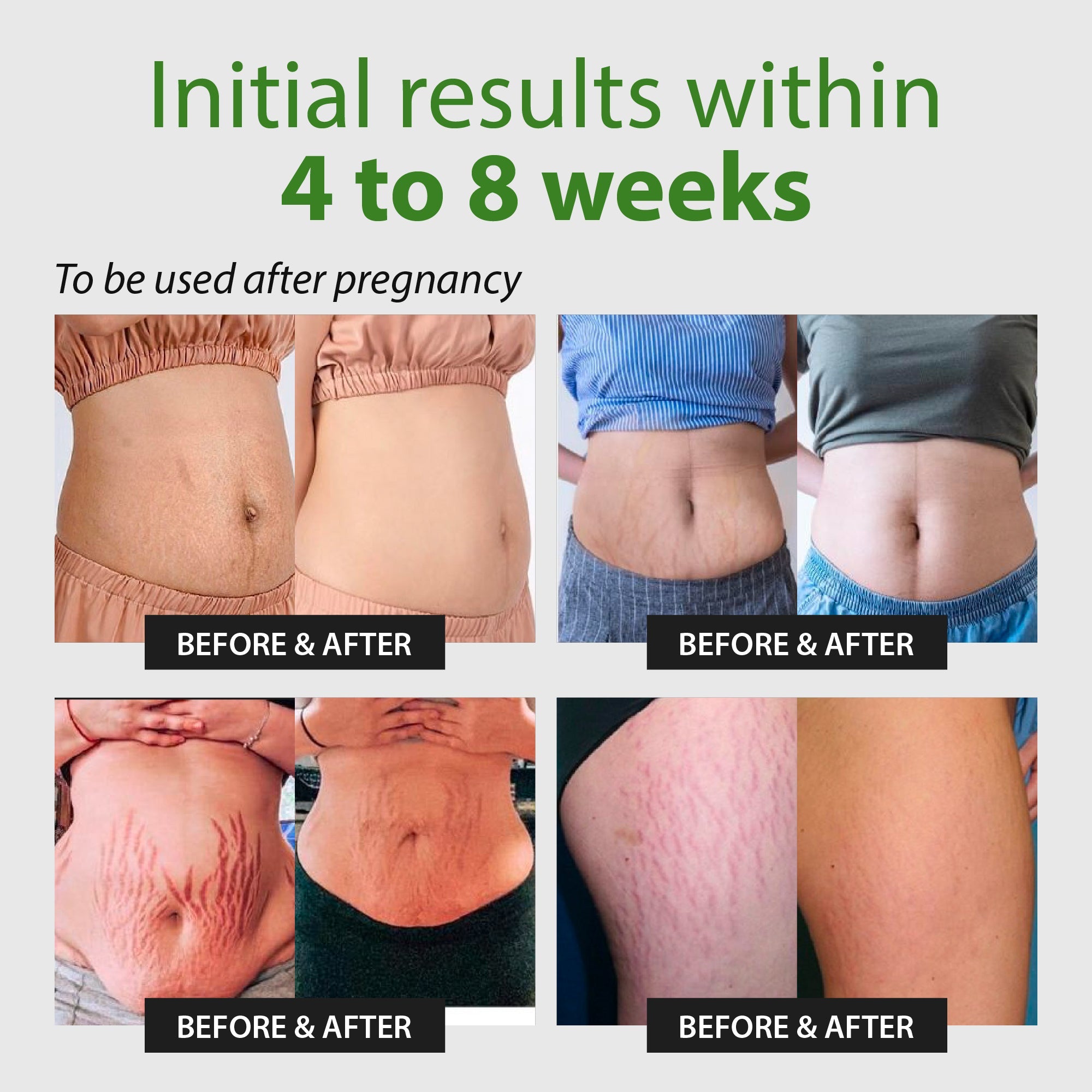 ABERA Ovela Stretch Mark Cream for Pregnancy