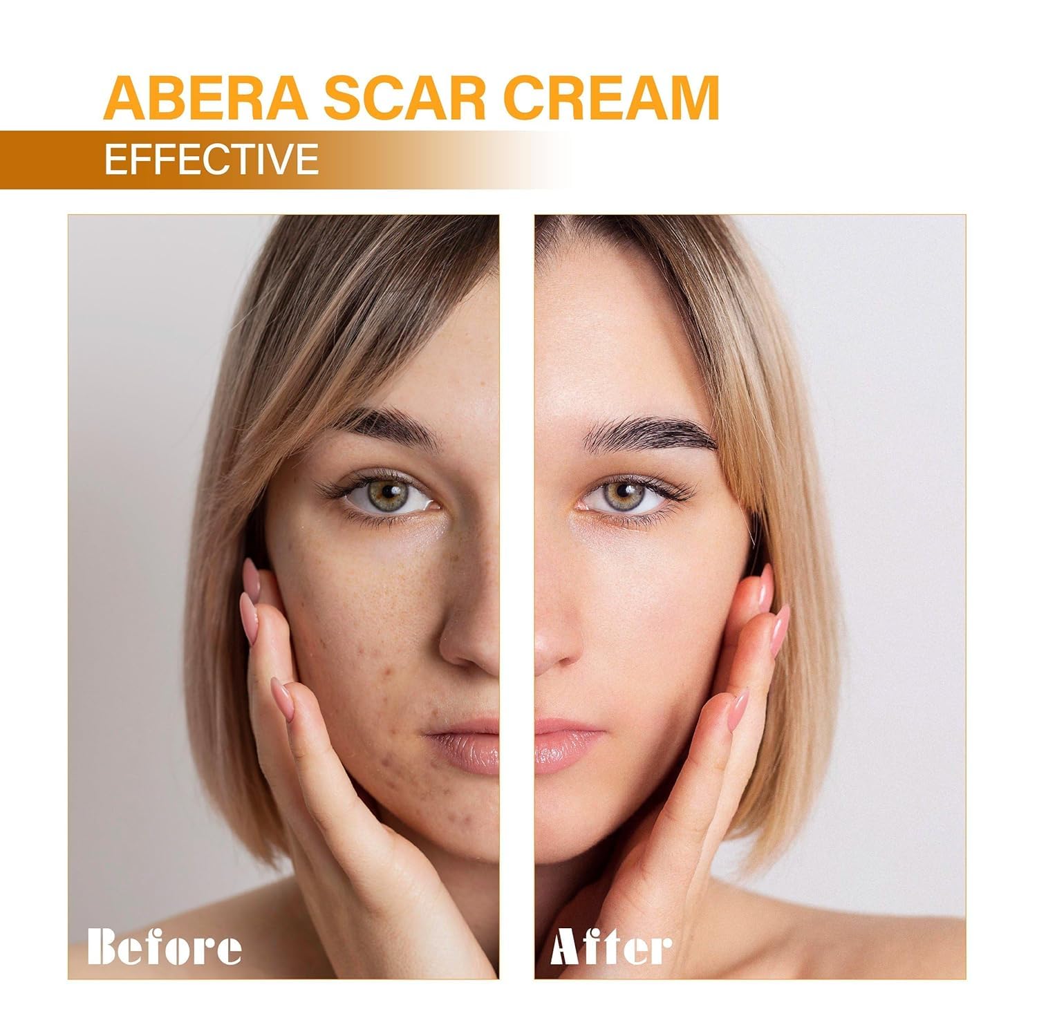ABERA Red Turmeric Scar Removal Cream