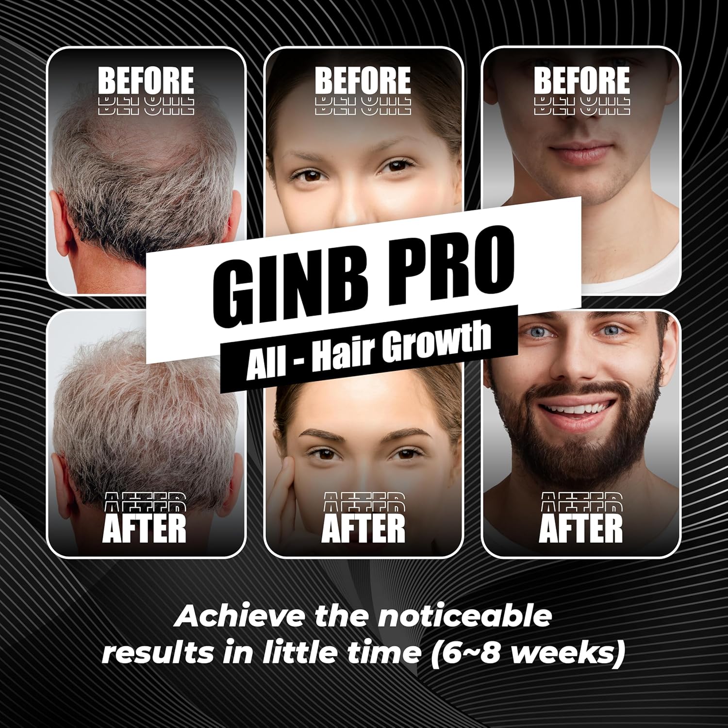 Abera Ginb Advanced Growth Beard & Eyebrows Serum For Men 0.67 fl Oz