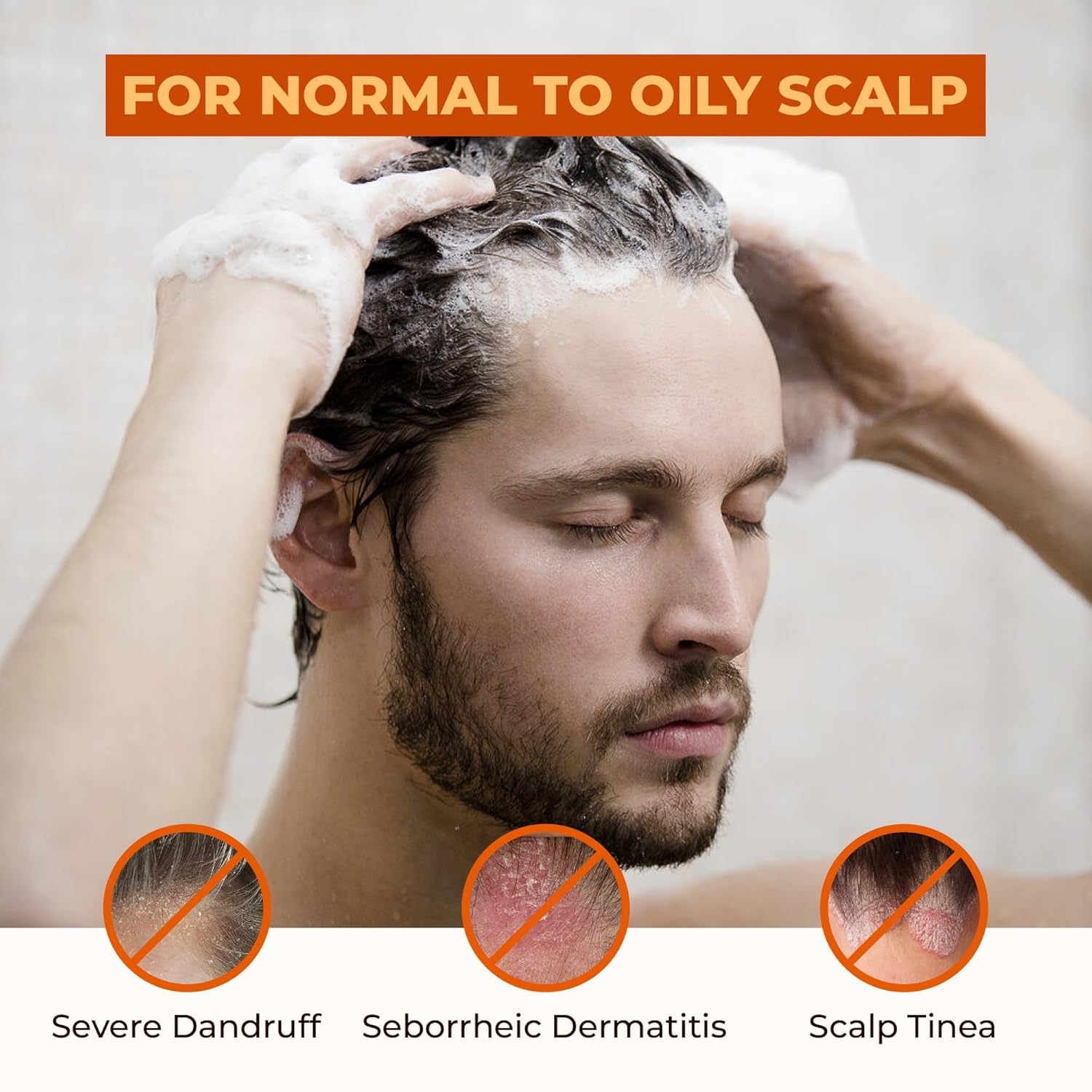 ABERA Anti-Dandruff Shampoo