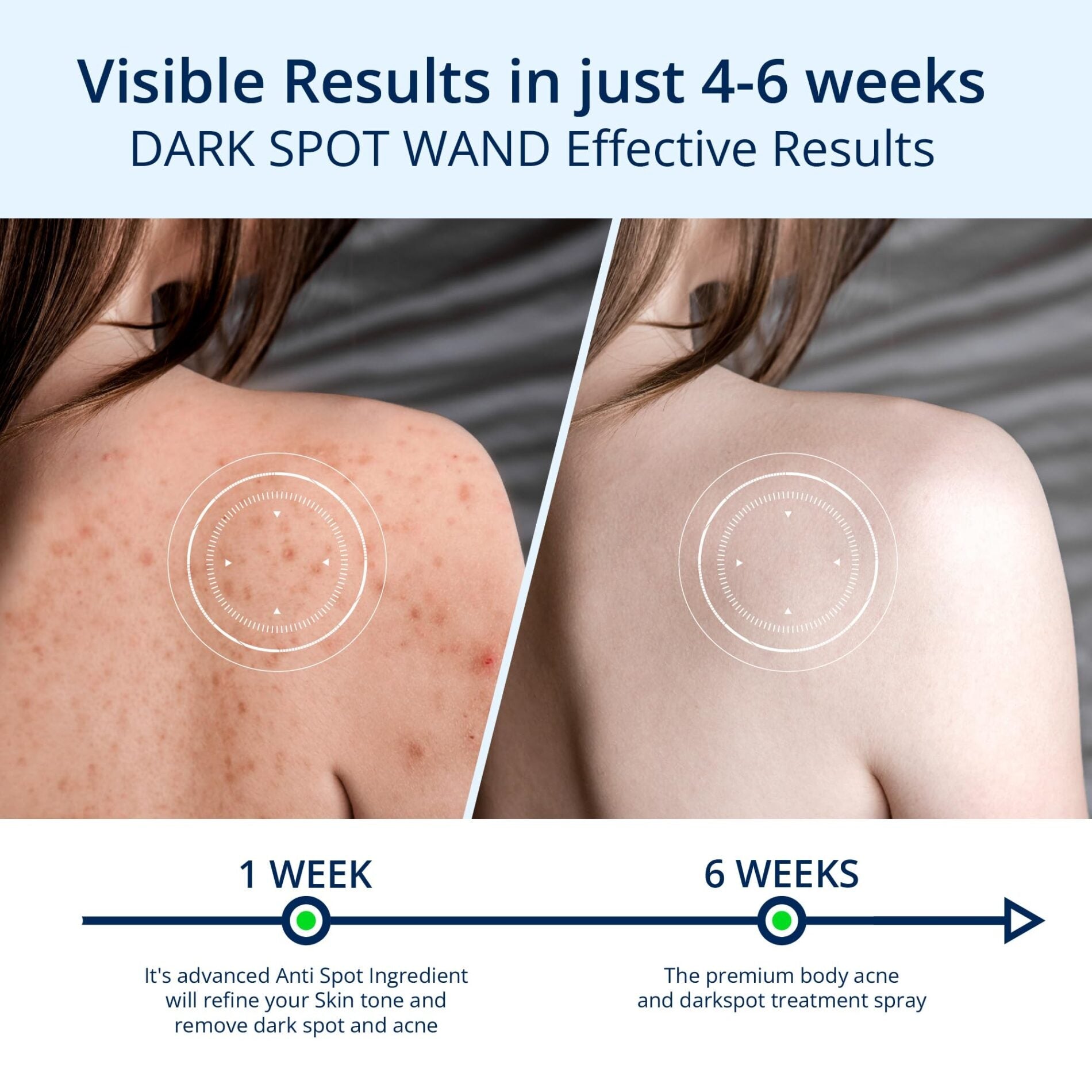 ABERA Clear Back & Body Exfoliating Acne Spray