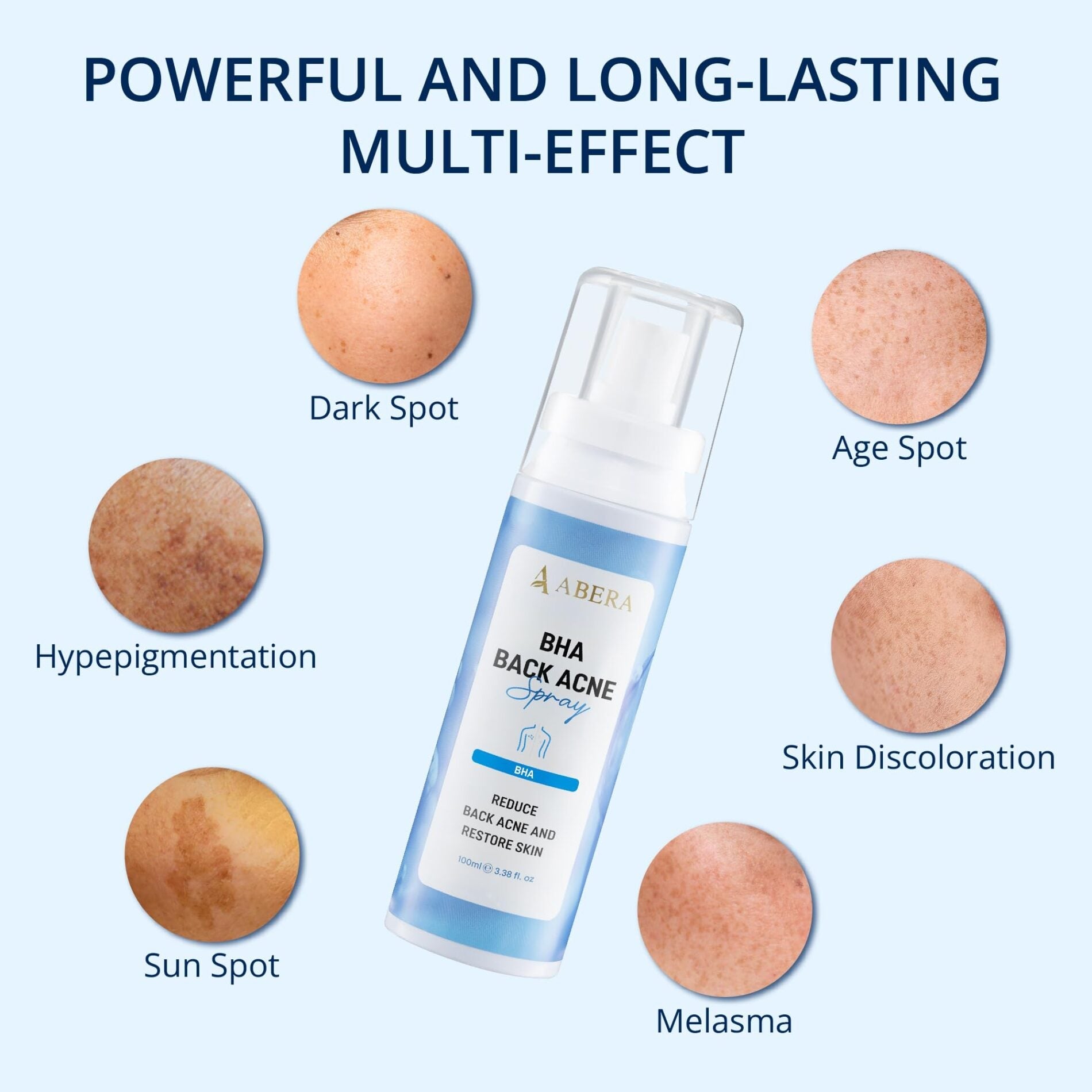 ABERA Clear Back & Body Exfoliating Acne Spray