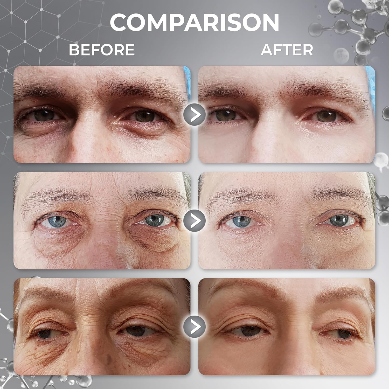 Abera Eye Revitalizing Essence